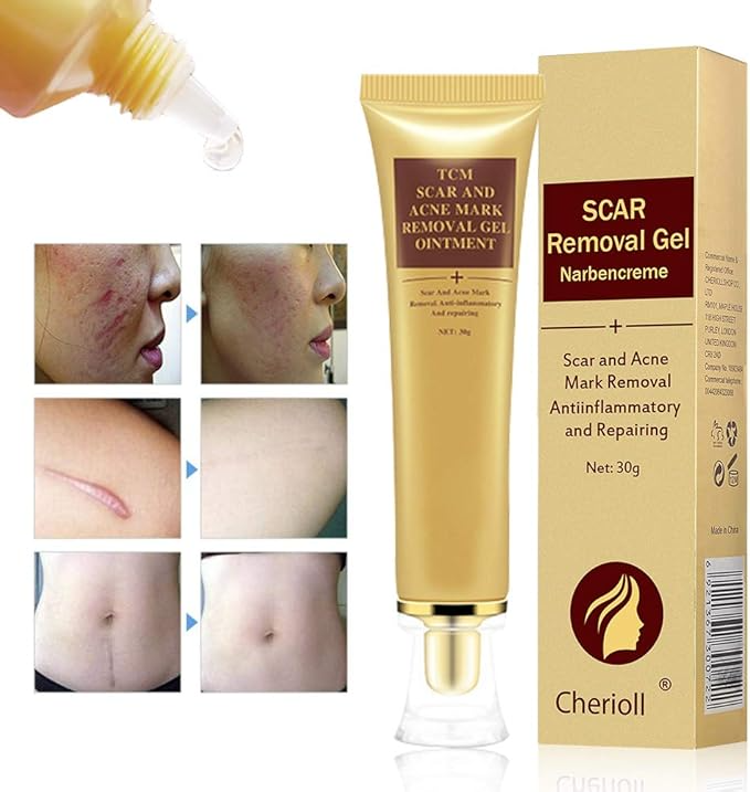 Scar & Acne Mark Removal - पुराना दागहरू हटाउने प्रभावकारी समाधान!