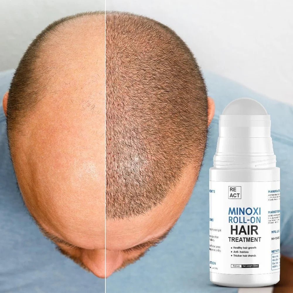 Minoxi Roll-on Hair Growth Serum: Nourishing Scalp Treatment for Thicker, Fuller Hair