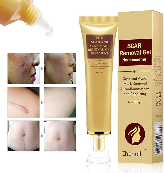 Scar & Acne Mark Removal  - पुराना दागहरू हटाउने प्रभावकारी समाधान!