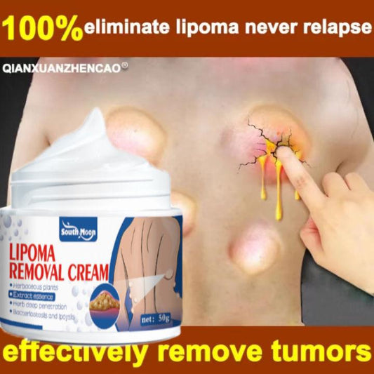 Natural Lipoma Removal Cream | Free Home Delivery